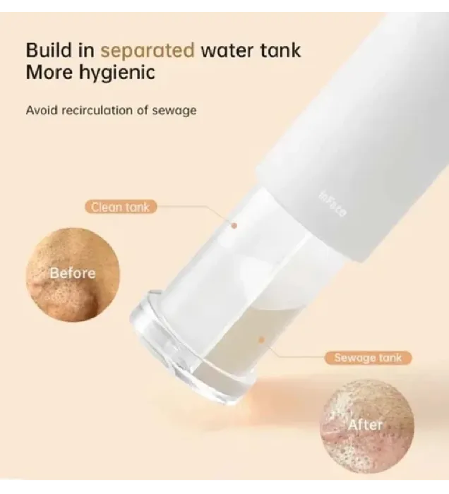 تصویر  دستگاه پاکسازی صورت (میکرودرم) شیائومی مدل CF-07E